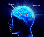 aphasic syndromes