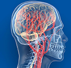 cerebrovascular disorders